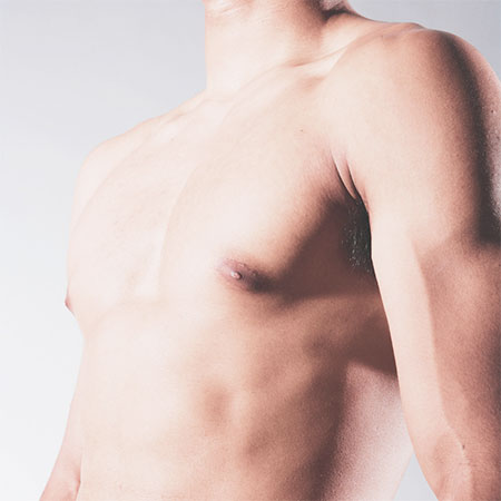 Male Breast Reduction