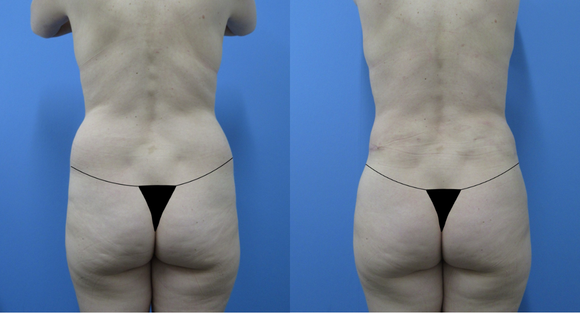  width='580