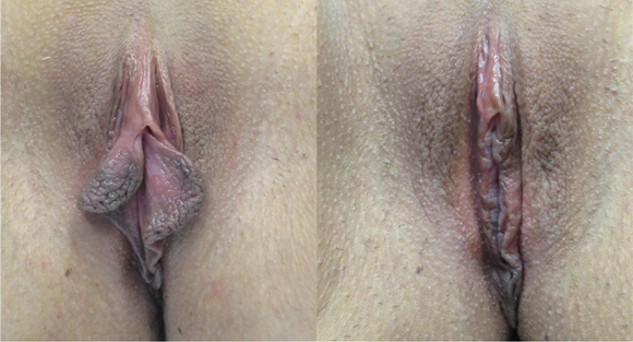  width='580