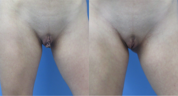  width='580