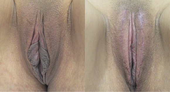  width='580