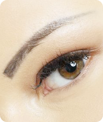 Brow Lift