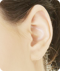 Ear Pinback